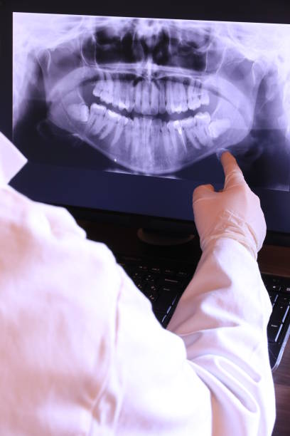 Best Emergency Root Canal Treatment in Big Rapids, MI