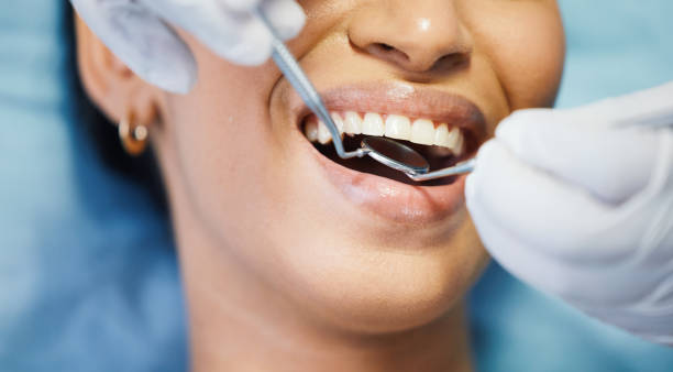 Best Emergency Wisdom Teeth Removal in Big Rapids, MI