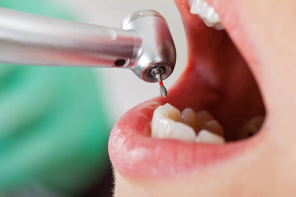 Best Emergency Dental Care for Broken or Chipped Teeth in Big Rapids, MI